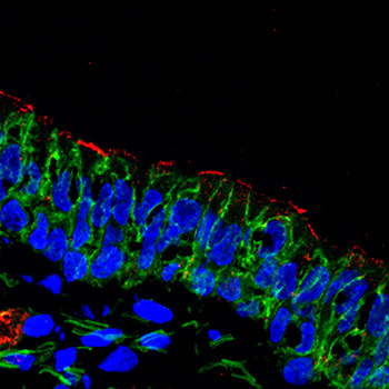 Airway cells image