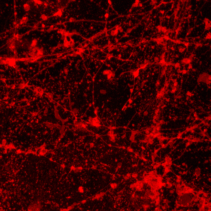 Scan of a brain related to bi-polar disorder