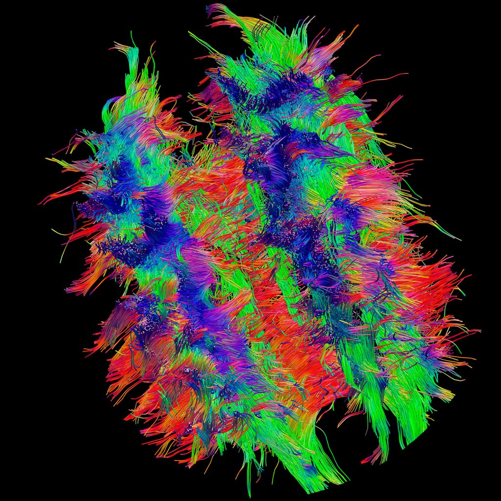 visualization of the wiring of the human brain