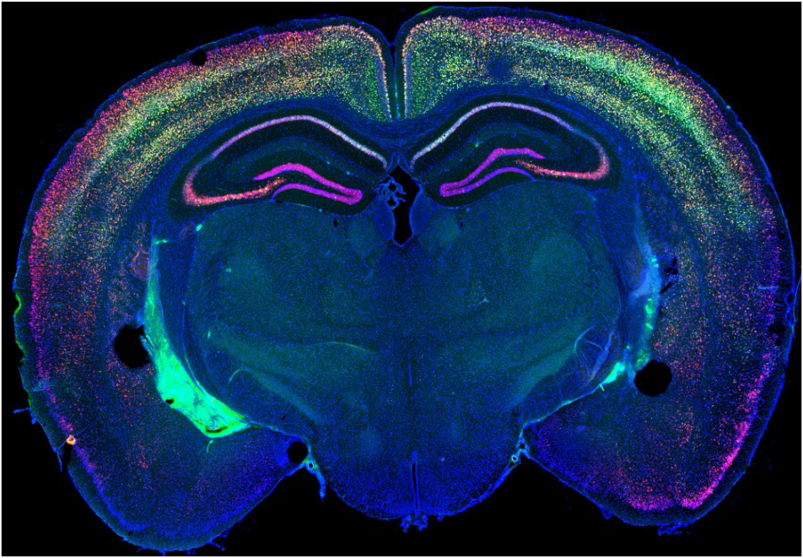 Modern molecular approaches enable the mapping of gene expression to specific brain regions. Work in the Abel lab used one of these new techniques, spatial transcriptomics, to look at gene expression across the genome and across the brain  