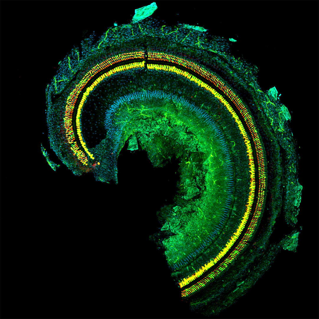 Mouse organ of Corti