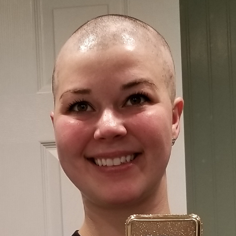 Cody Purvis' alopecia areat recovery progress with her smiling in the mirror
