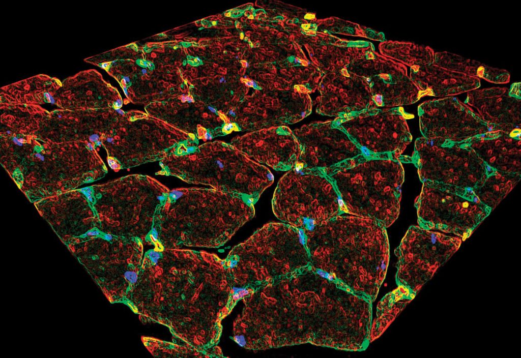 image of a cross section of mouse muscle, showing macrophages (green), purinergic receptors (red), and nuclei (blue)