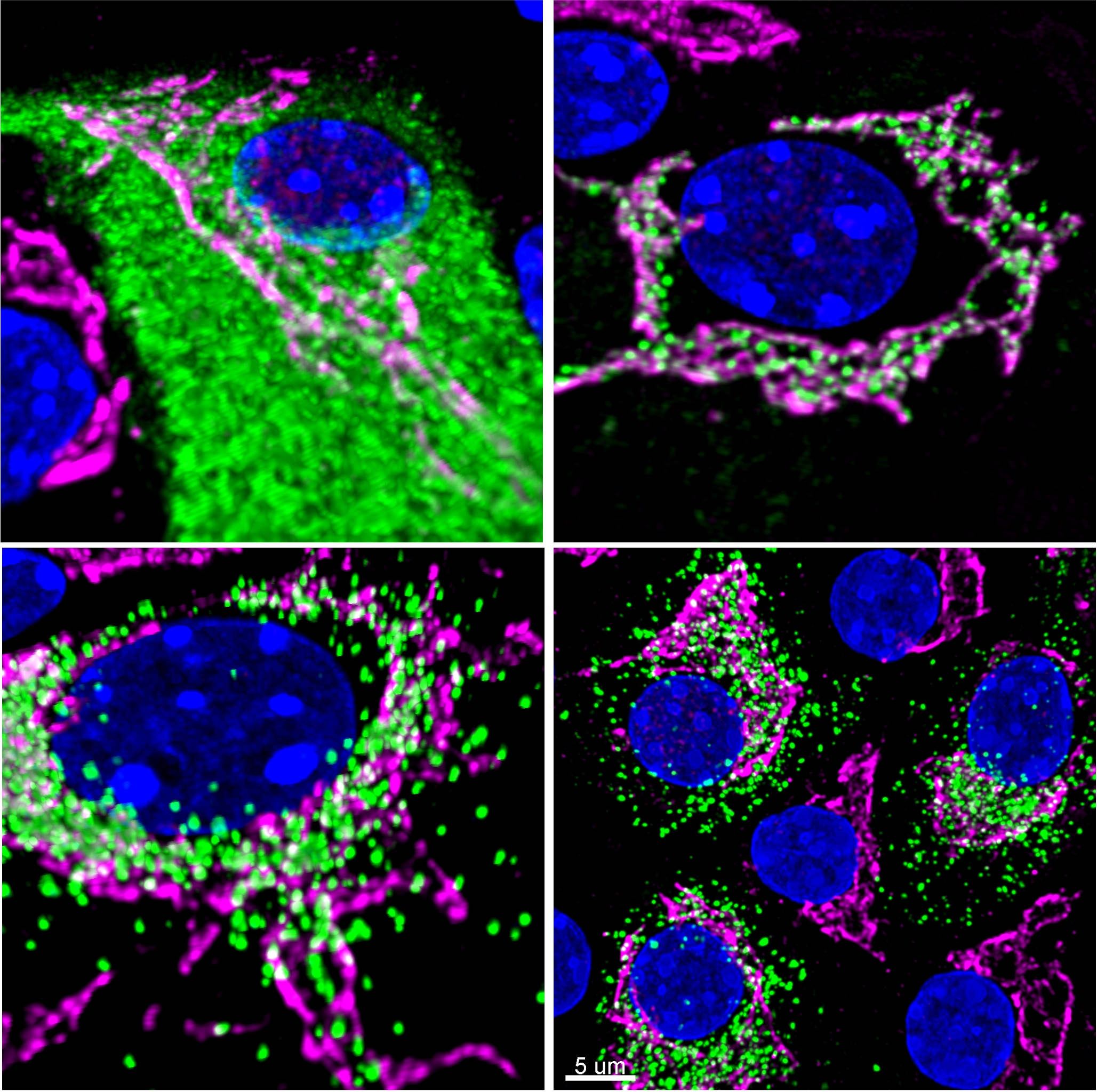 Microscopy image from Sam Stephens lab