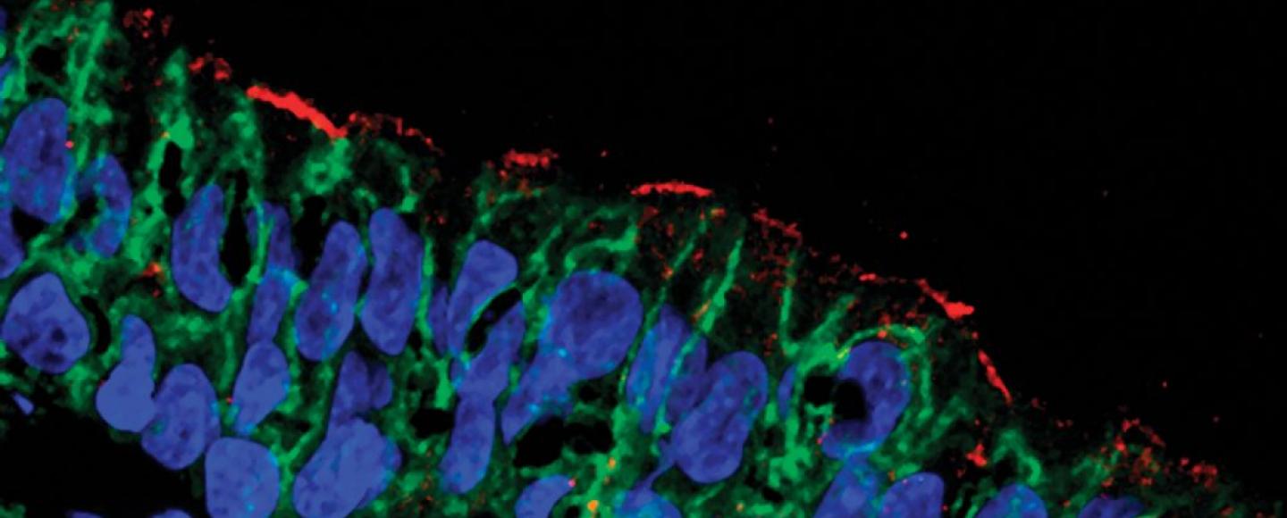 image of CFTR protein present in airway cells