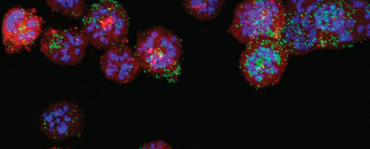 image of super-lethal nanoparticles and attack tumor cells