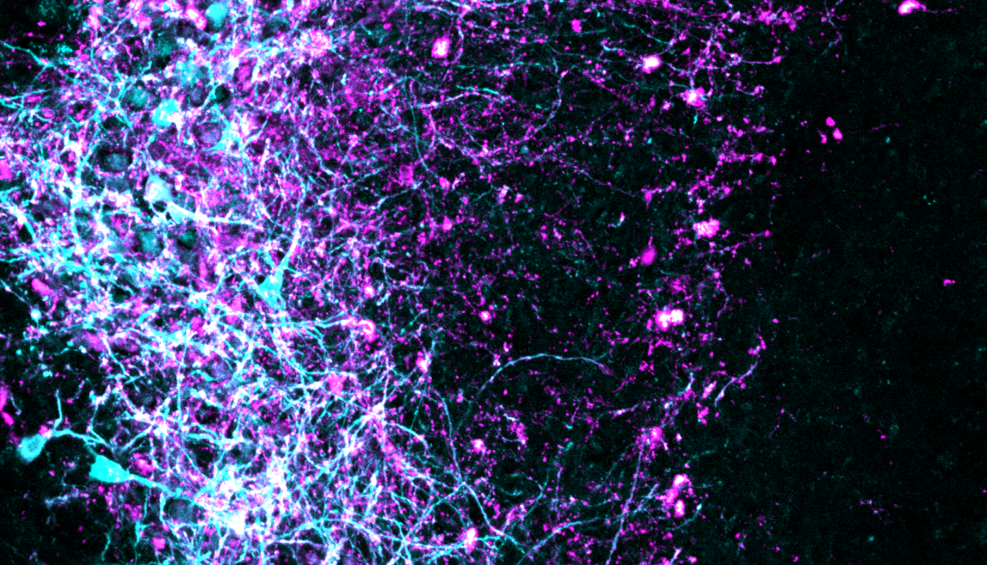 Image showing noradrenaline-producing brain cells in the locus coeruleus (cyan) expressing an engineered light-gated channel (magenta)