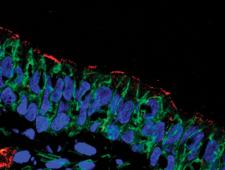 image of CFTR protein present in airway cells