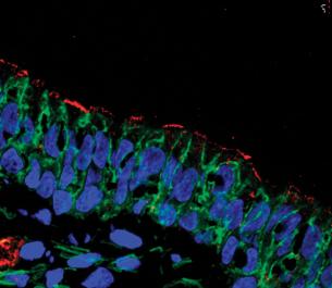 image of CFTR protein present in airway cells