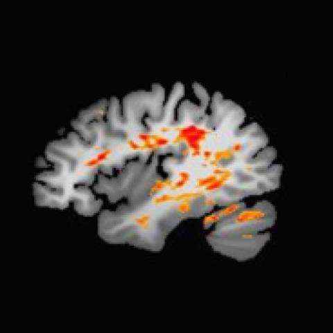 Brain imaging placeholder photo