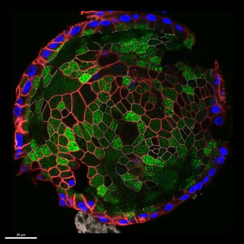 Human gallbladder epithelial organoid, a mini-representation of an organ, grown in a dish.