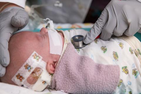Nash Keen, world's most premature baby