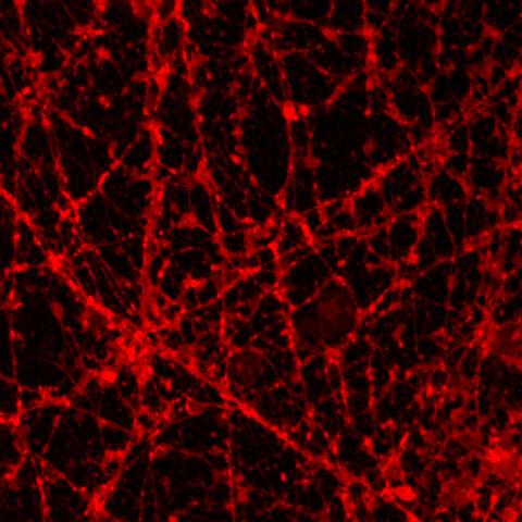 Scan of a brain related to bi-polar disorder