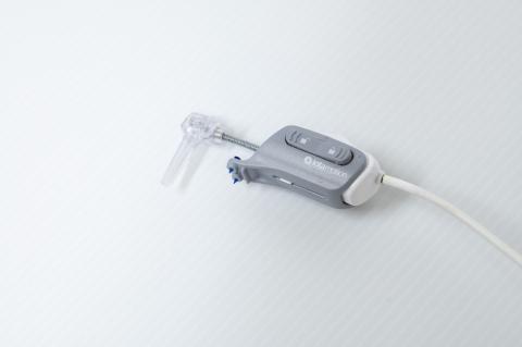 Iota Motion implant