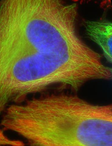 HeLa cells