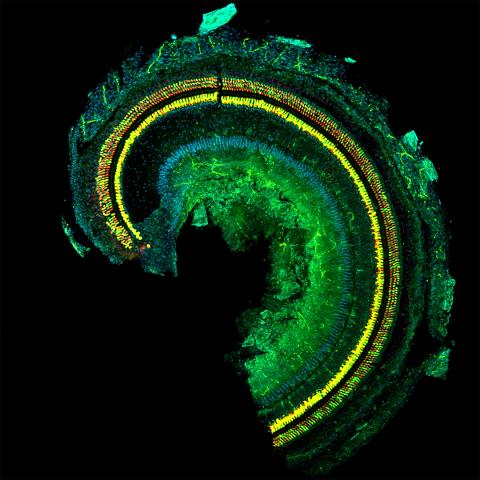 Mouse organ of Corti