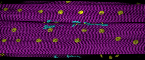 fluorescently labeled neuromuscular junctions image