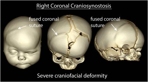 Preoperative 3d CT